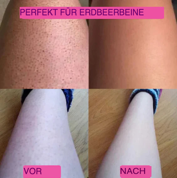 Doppelkopf-Trimmer
