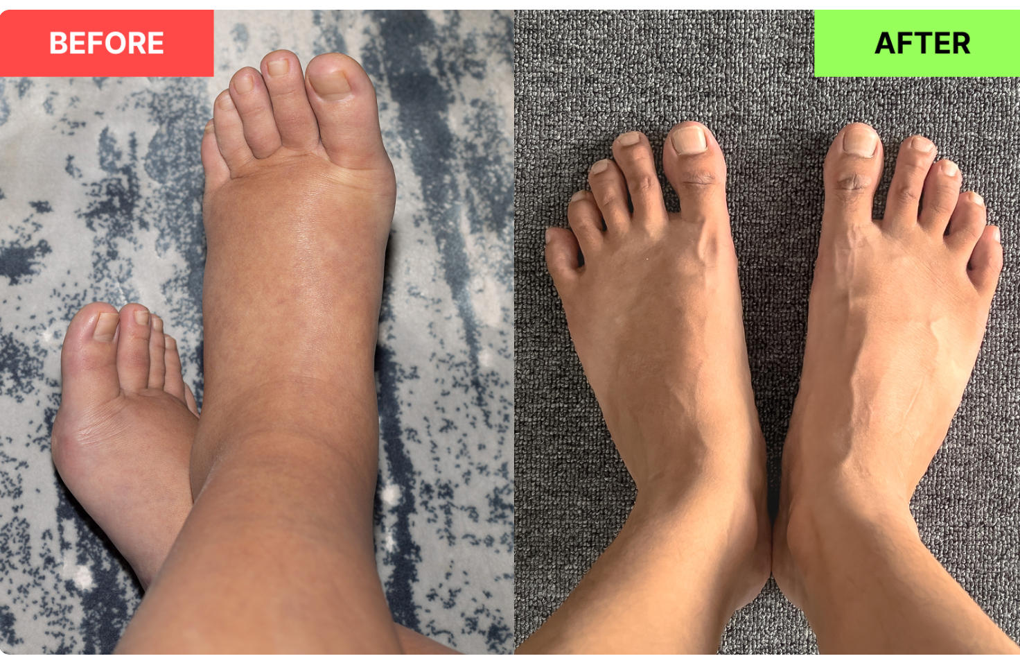 #2 Reduce Swollen Feet and Heavy Legs 