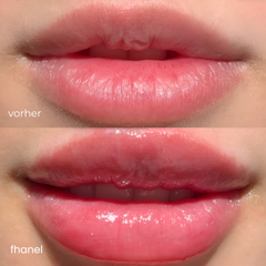LipBoost® - Das Original