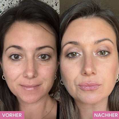 LipBoost® - Das Original